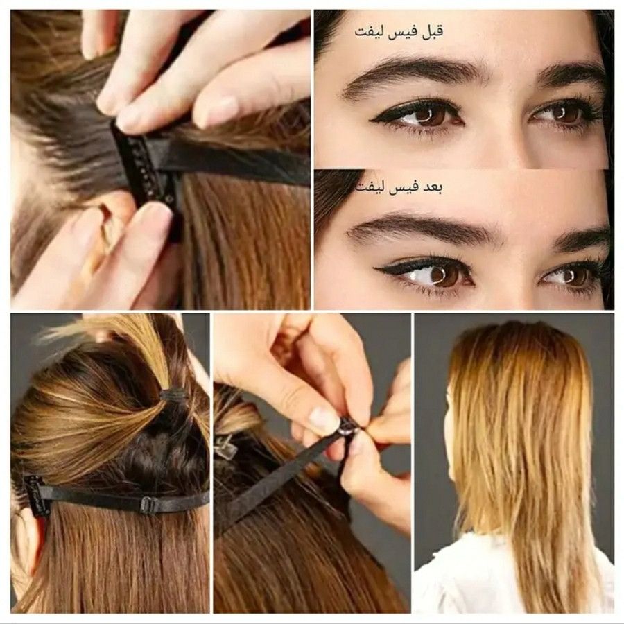 کش لیفت شقیقه