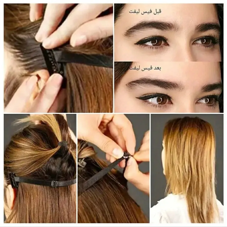 کش لیفت شقیقه