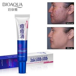 کرن اورژانسی ضدجوش اکوا